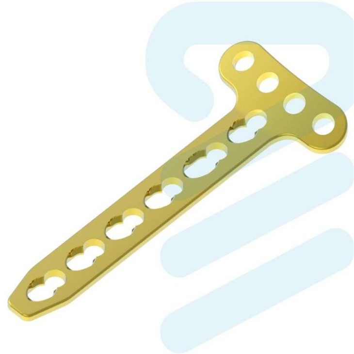 lcp distal radius plate