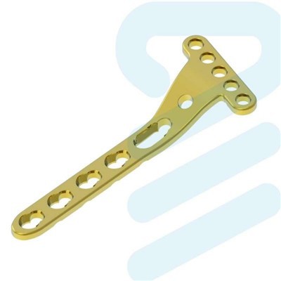 Distal radíus læsiplata