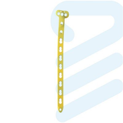 Proximal Medial Tibial Plate